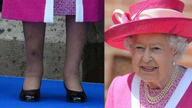 Alžběta II. ukázala bolestivý »doplněk«: Na holeni se královně modrala obrovská modřina