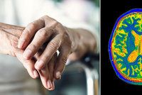 Žádné zázračné léky, na alzheimera pomáhá spánek a zdravá strava! Česká vědkyně řekla: Ano, ale...