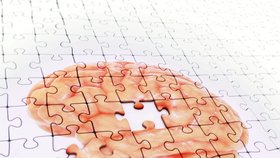 V Česku vzrůstá počet pacientů s demencí: Nejčastější příčinnou onemocnění mozku je Alzheimerova choroba.