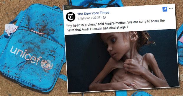 Holčička Amal (†7) zemřela v Jemenu hlady. Její fotka šokovala svět