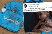 Holčička Amal (†7) zemřela v Jemenu hlady. Její fotka šokovala svět