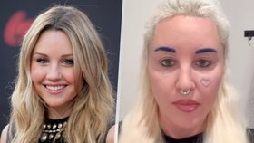 Kontroverzní herečka Amanda Bynesová: Přiznala plastiku v obličeji!