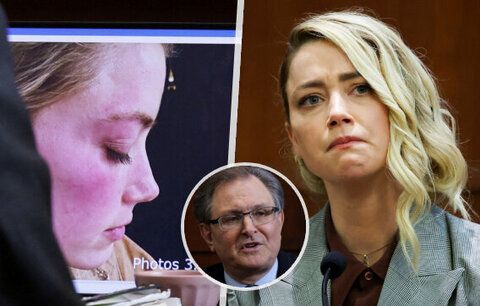 Zvrat v případu Deppa a Heardové: Důkaz o týrání je podvrh! tvrdí expert
