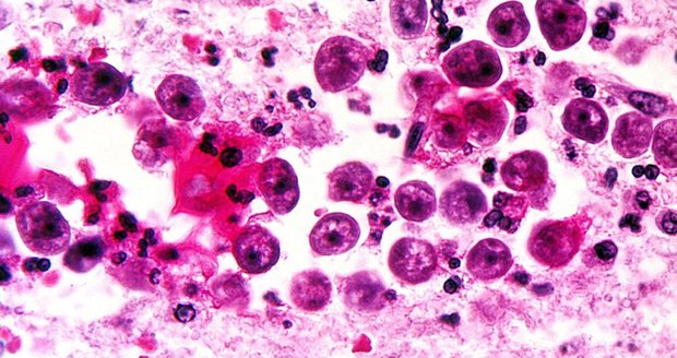 Naegleria fowleri - améba pod mikroskopem