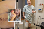 Osmadvacetiletá žena si nechala dobrovolně amputovat nohu