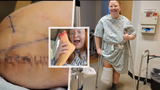 Američanka si nechala amputovat nohu: Drsný vzkaz a šokovaní lékaři 