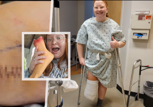 Osmadvacetiletá žena si nechala dobrovolně amputovat nohu