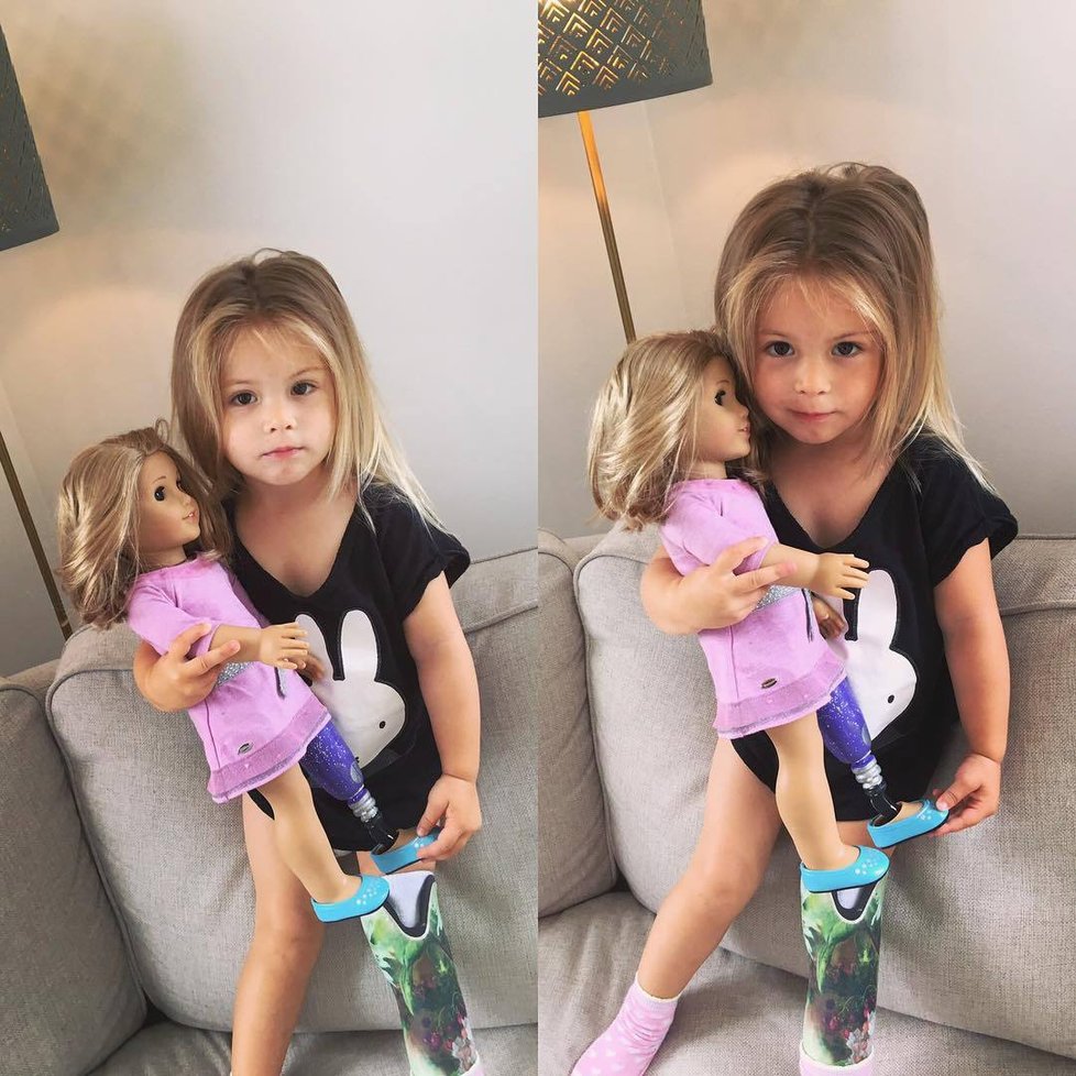Její panenka má podobnou protézu jako ona sama!