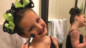 Malá hrdinka! Šestileté dívce amputovali nohu, přesto vyhrává taneční soutěže