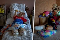 Šokující fotografie z ukrajinských nemocnic: Takhle mrzačí Rusové celé rodiny