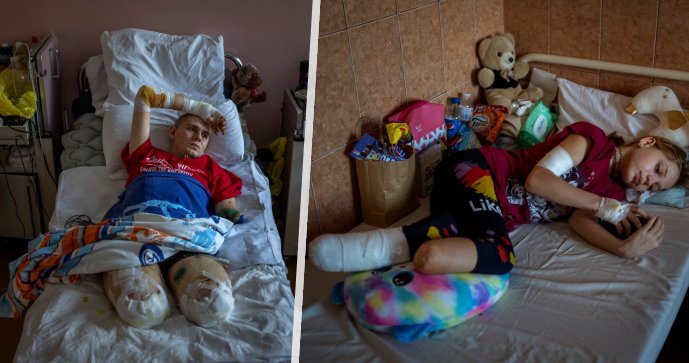 Příběhy civilistů s amputovanými končetinami: Tragickému osudu se nevyhnuly ani děti.