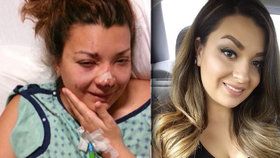 Amy Castanon zasáhl blesk a lékaři si mysleli, že žena přežije. Vyvedla je ale z omylu a plně se zotavila.