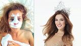 Česká Miss 2016 Andrea Bezděková: Jen 83 dní po zvolení šla a plastiku!