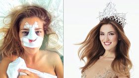 Česká Miss 2016 Andrea Bezděková: Jen 83 dní po zvolení šla a plastiku!