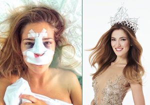 Andrea Bezděková necelé tři měsíce od získání korunky krásy podstoupila plastiku nosu.