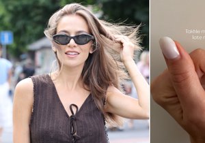 Andrea Bezděková se ošklivě zranila...