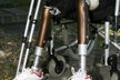 Protézy jsou založeny na moderních technologiích.