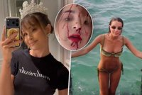 Krásná miss v kaluži krve: Na festivalu v Cannes ji napadl stylista