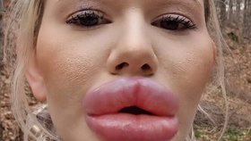 Andrea se výplní rtů nikdy nevzdá