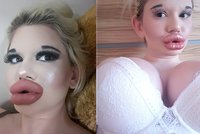 Andrea, která překvapila svět svými extrémními rty, opět šokuje: Zvětšila se i jinde!