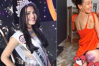 Miss Kalousová má místo zadku jednu velkou modřinu! Copak se stalo?
