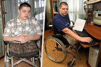 Ruského vojáka tři hodiny bil jeho nadřízený: Lékaři mu museli amputovat nohy a genitálie