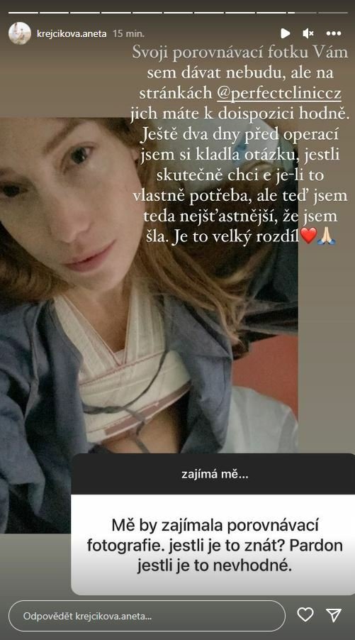 Aneta Krejčíková prozradila detaily o modelaci prsou.