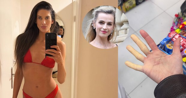 Aneta trpí stejným syndromem jako Ivana Jirešová.