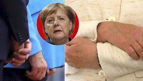 Spekulace o zdravotním stavu německé kanléřky Angely Merkelové nepřestávají. Možná je psychosomatická příčina i neurologický problém