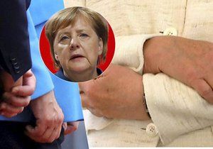 Spekulace o zdravotním stavu německé kanléřky Angely Merkelové nepřestávají. Možná je psychosomatická příčina i neurologický problém