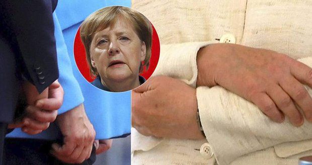 „Trpí Parkinsonem?“ Třetí třes Merkelové rozvířil nové teorie o vážné nemoci