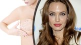 Preventivní odstranění prsů: Proč se tak rozhodla i Angelina Jolie?