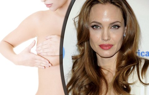 Preventivní odstranění prsů: Proč se tak rozhodla i Angelina Jolie?