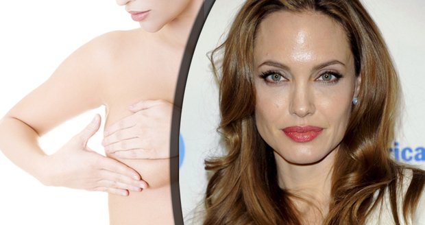 Angelina Jolie si nechala preventivně odstranit prsní žlázu