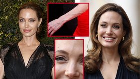 Angelina váží pouhých 44 kg! Její nízká váha odkrývá nevzhledné žíly, které Angelině hyzdí obličej, krk i ruce!