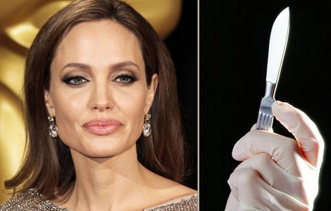 Angelina Jolie půjde kvůli rakovině znovu pod skalpel: Nechá si odstranit vaječníky!