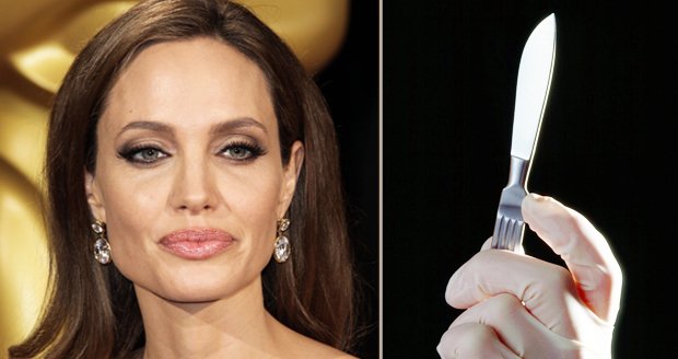 Angelina Jolie půjde kvůli rakovině znovu pod skalpel: Nechá si odstranit vaječníky!