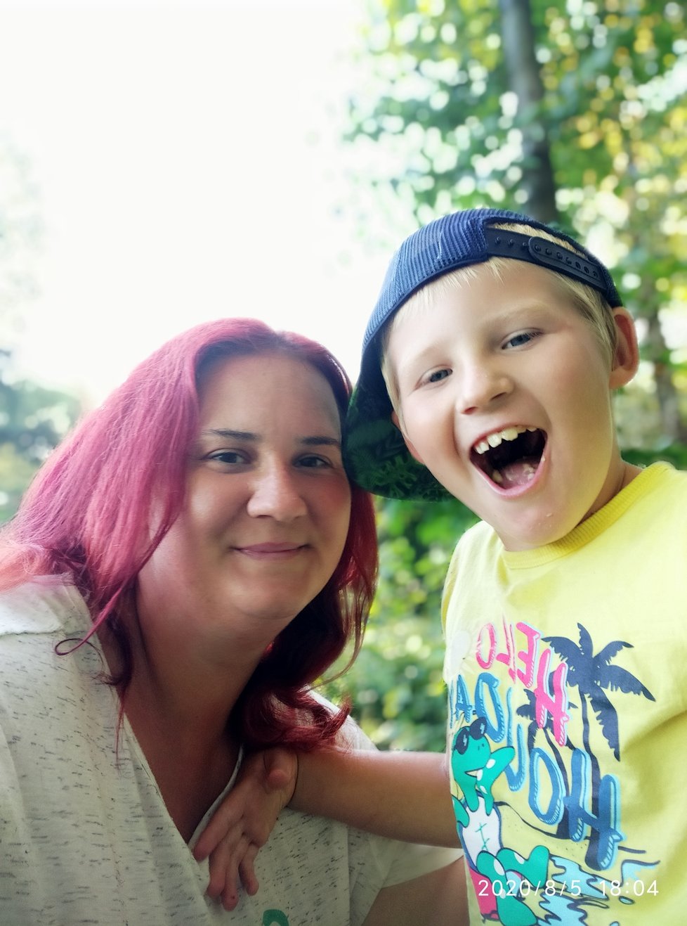 Tadeáš (7) se narodil s Angelmanovým syndromem. Dnes se pacientům s touto nemocí říká také andělské děti.