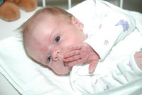 Zdravotní sestra upustila novorozence (3 dny) při přebalování na zem