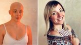 Anička Slováčková po rakovině: Přetrvávající problém vyřešila proměna účesu!