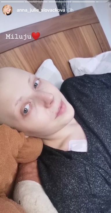 Anička Slováčková po chemoterapii.