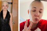 Anička Slováčková bojuje podruhé v životě s rakovinou.