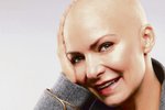 Rakovina a následná chemoterapie připravily zpěvačku Annu K. o vlasy