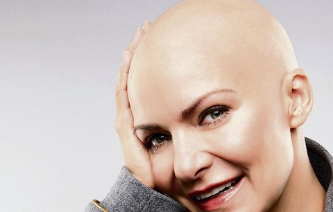 Anna K. má rakovinu prsu: Teď bojuji o život!