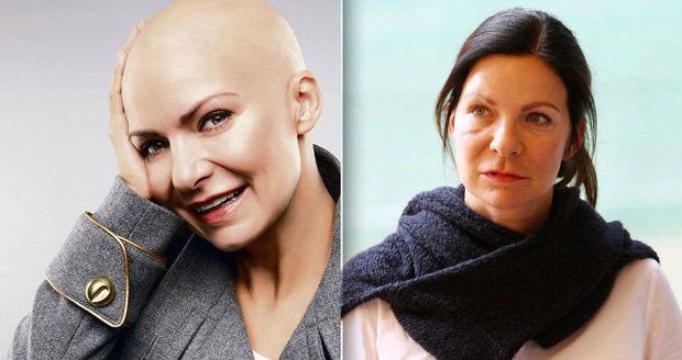 Anna K., která  znovu bojuje s rakovinou: Mám za sebou třetí chemoterapii a ještě mne dlouhá, trochu trnitá cesta čeká!