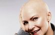 2010: Před sedmi lety statečně bojovala s rakovinou a nestyděla se ani za holou hlavu.