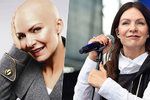 Zpěvačka Anna K. podruhé bojuje s rakovinou.