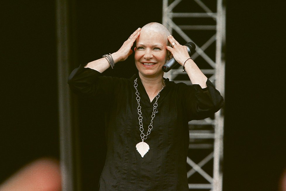 Kvůli chemoterapiím Anna přišla o všechny vlasy.