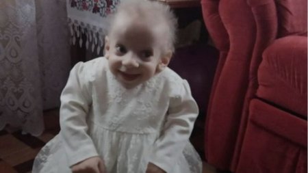 Osmiletá Anna zemřela v biologickém věku zhruba osmdesáti let. Trpěla nemocí zvanou progerie.
