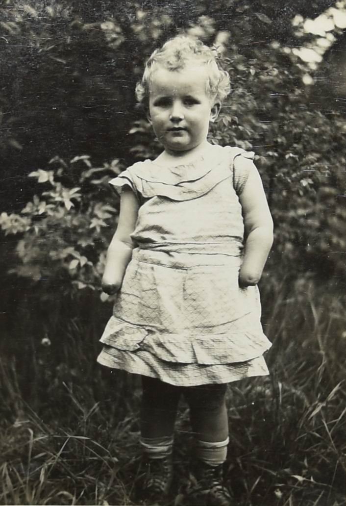 Anna Váchalová (88) jako malá holčička v Jedličkově ústavu pro zmrzačené děti v Praze